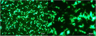 B1 siRNA Increases de novo DNA Methylation of B1 Elements and Promotes Wound Healing in Diabetic Rats